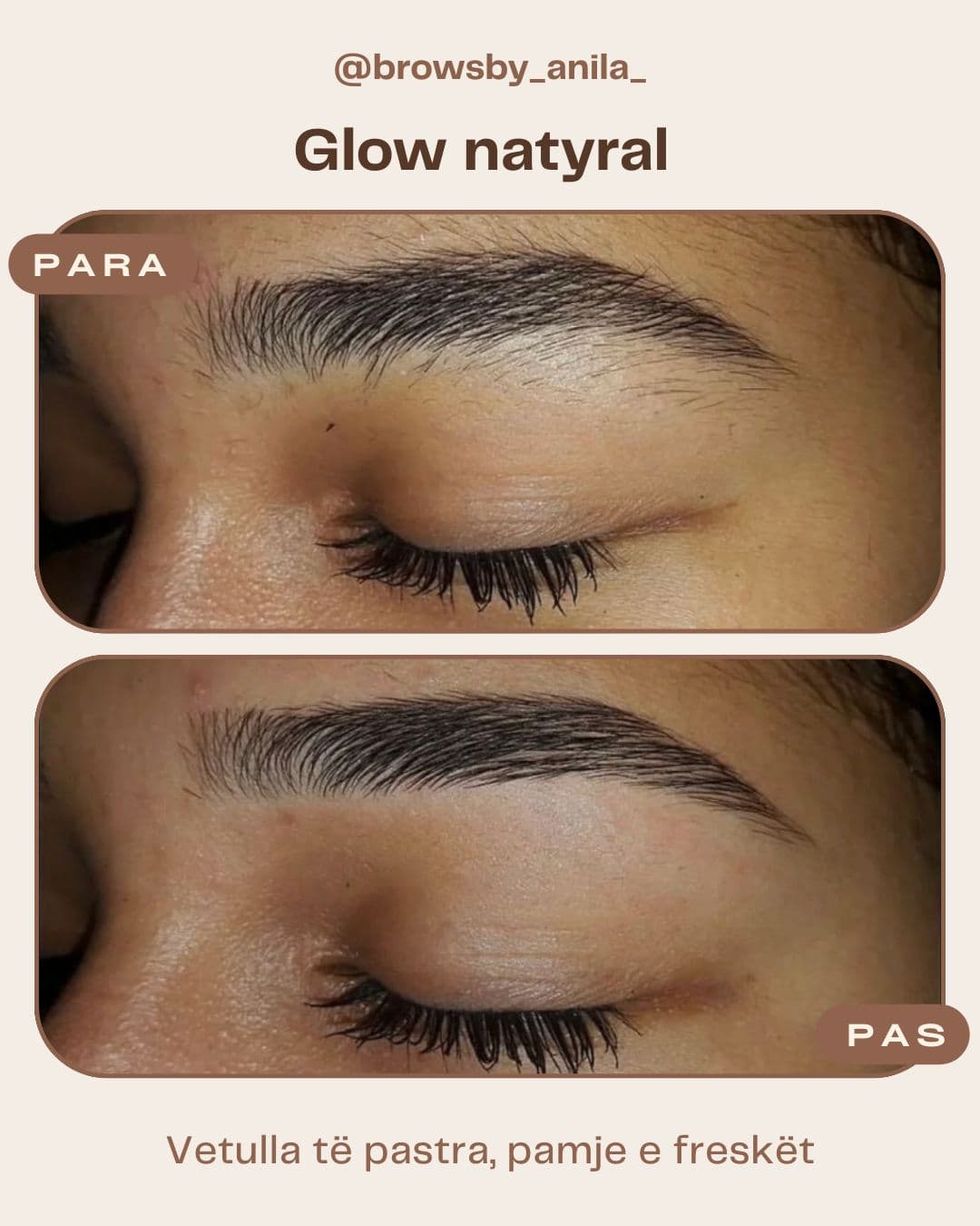 Brows By Anila - 2