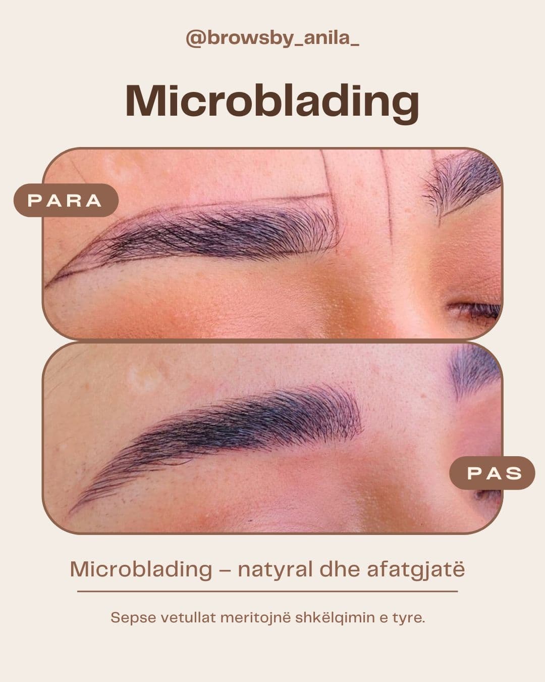 Brows By Anila - 6